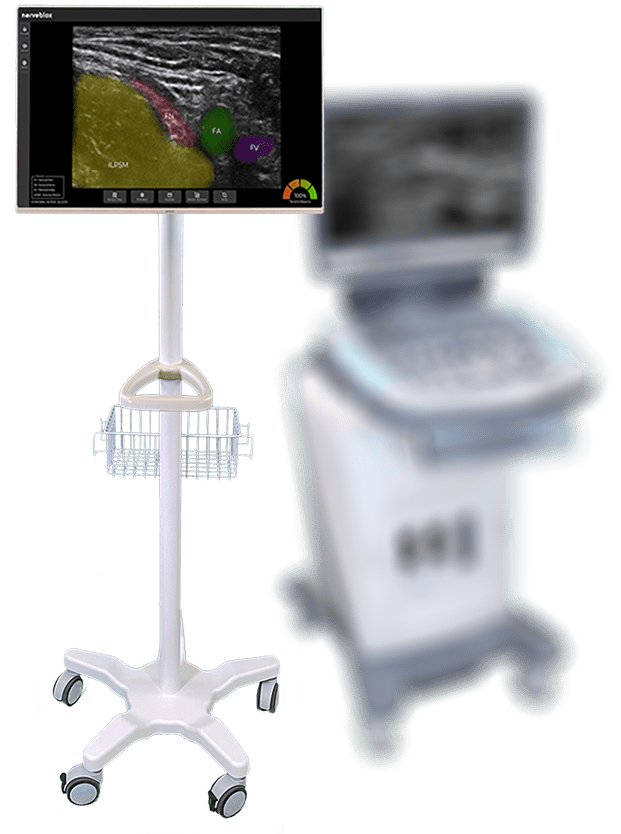 nerveblox-clinic-and-ultrasound-min